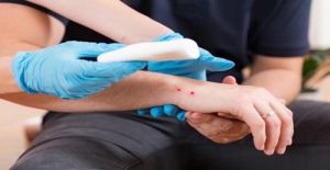 Nhiều trường hợp bị rắn cắn nguy hiểm