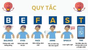 Bệnh viện Thuận Mỹ ITO Đăng Nhập Chính Thức OK9 cấp cứu thành công cho bệnh nhân bị đột quỵ nặng