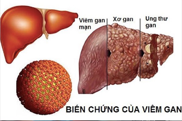 viem gan B - la gan.jpg